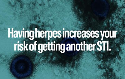 Having herpes increases your risk of getting another STI
